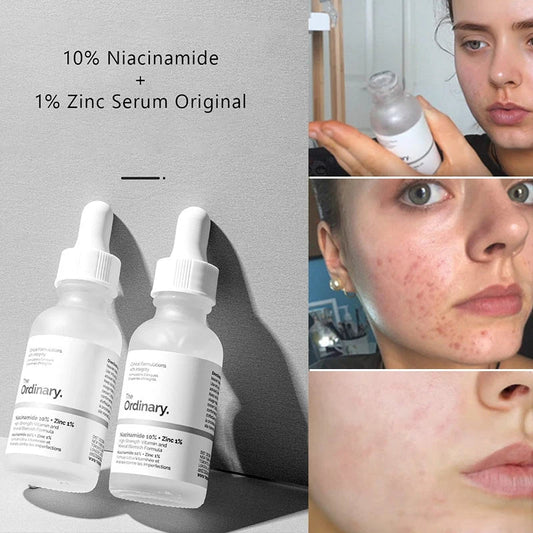 Ordinary Serum Niacinamide 10% + Zinc 1%