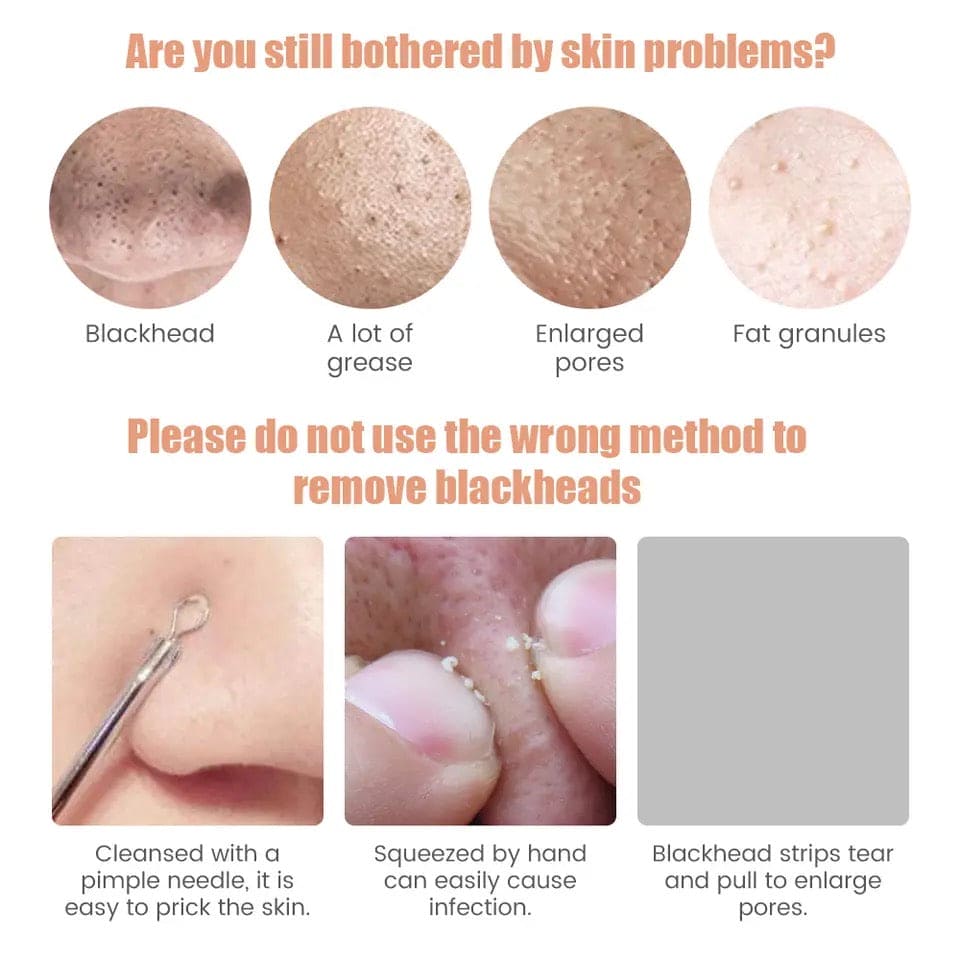 Electric Blackhead Remover, Vacuum Acne Cleane